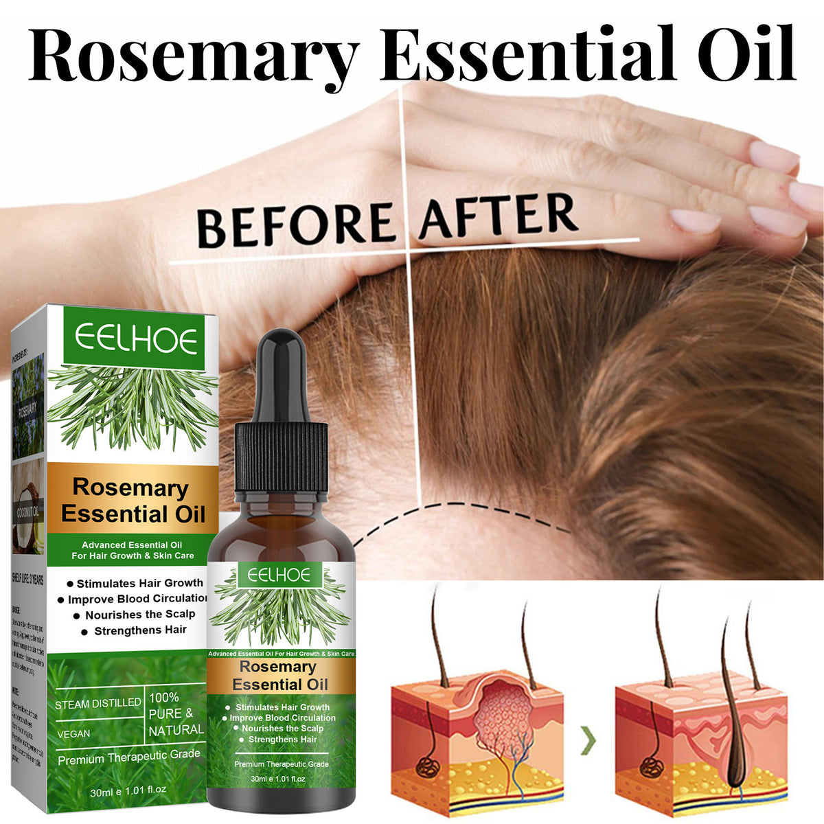 Rosemary Essential Oil for Hair Growth - 100% Pure Anti-Loss Treatment