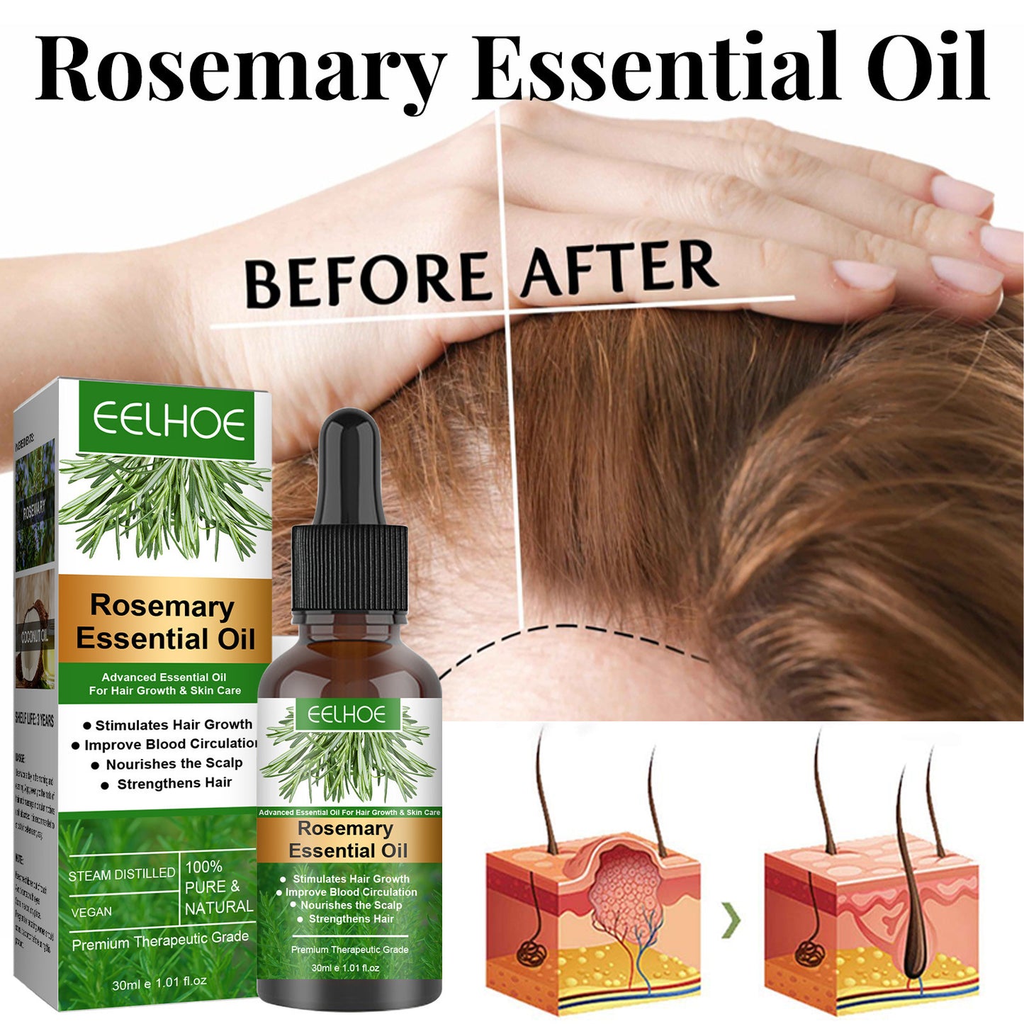 Rosemary Essential Oil for Hair Growth - 100% Pure Anti-Loss Treatment